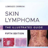 (eBook PDF)Skin Lymphoma: The Illustrated Guide 5th Edition by Lorenzo Cerroni