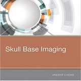 (eBook PDF)Skull Base Imaging  by Vincent Chong MD