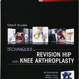 (eBook PDF)Techniques in Revision Hip and Knee Arthroplasty by Giles R Scuderi MD
