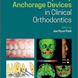 (eBook PDF)Temporary Anchorage Devices in Clinical Orthodontics 1st Edition by Jae Hyun Park