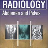 (eBook PDF)Textbook of Radiology: Abdomen and Pelvis by Hariqbal, M.D. Singh , Shailendra Savale