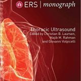 (eBook PDF)Thoracic Ultrasound (ERS Monograph 79) by Christian B. Laursen , Najib M. Rahman , Giovanni Volpicelli