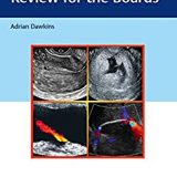 (eBook PDF)Ultrasound Q&A Review for the Boards by Adrian Dawkins