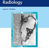 (eBook PDF)Venous Interventional Radiology by Laura K. Findeiss  Thieme; 1 edition (August 21, 2020)