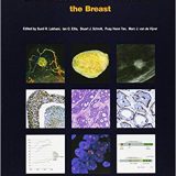(eBook PDF)WHO Classification of Tumours of the Breast 4e by International Agency for Research on Cancer
